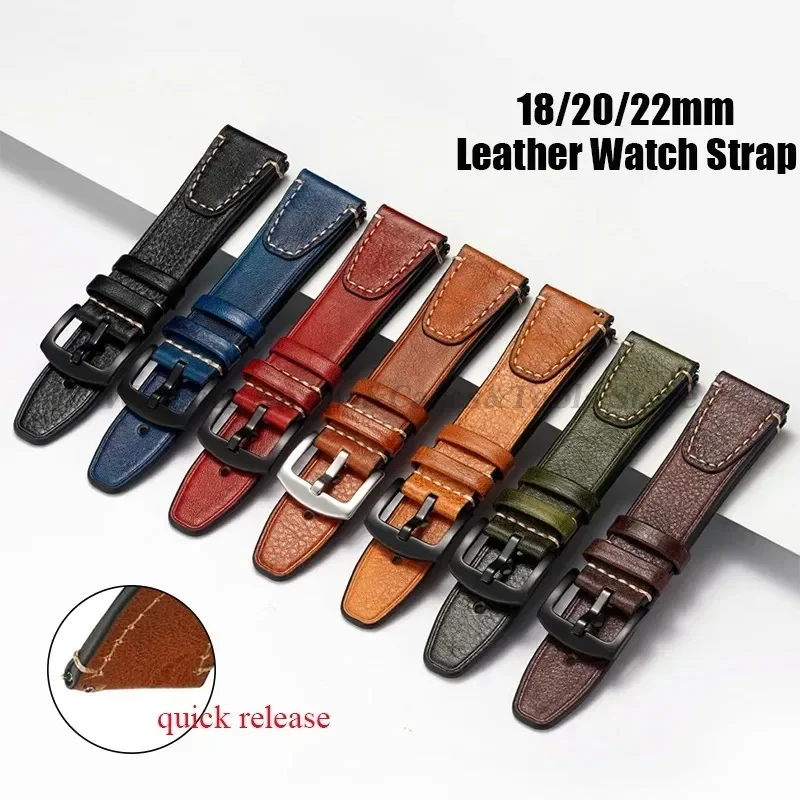 Watches Rolex Smartwatch - Gelang jam tangan Retro Universal untuk